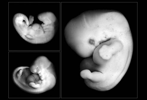 развитие плода на 4 неделе беременности
