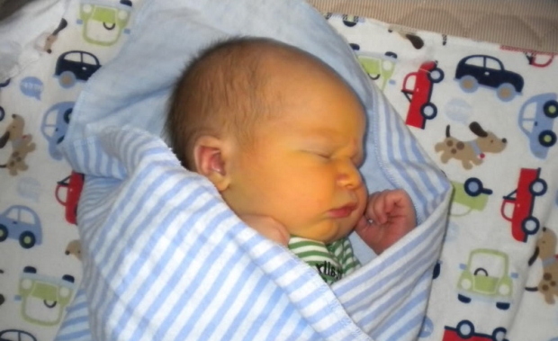 желтуха новорожденных