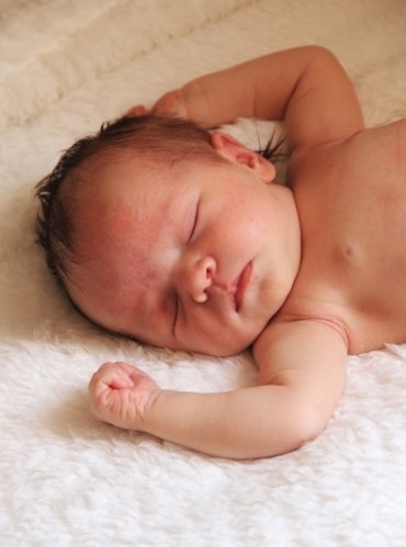 Нагрубание грудных желез у новорожденных