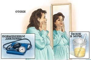 Преэклампсия и эклампсия у беременных