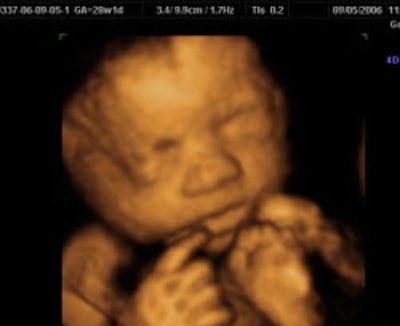 Фото УЗИ 28 неделя беременности