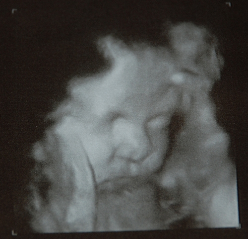 Фото УЗИ 40 неделя беременности