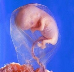 Фото плода на 8 неделе беременности (возраст плода 6 недель)