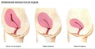 матка после родов