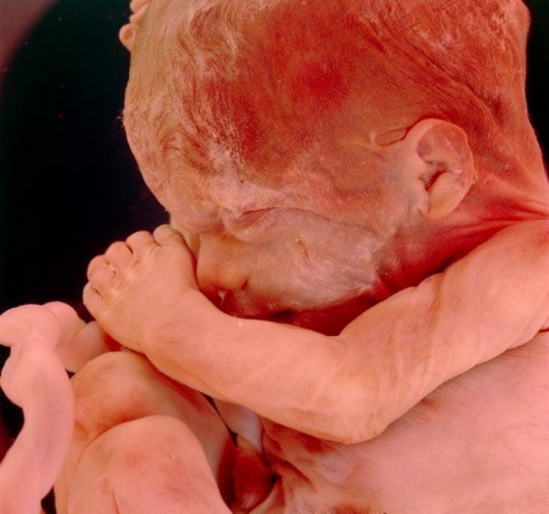 Фото плода на 16 неделе беременности (возраст плода 14 недель)