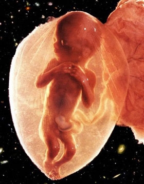 Фото плода на 18 неделе беременности (возраст плода 16 недель)