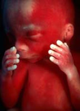 Фото плода на 19 неделе беременности (возраст плода 17 недель)