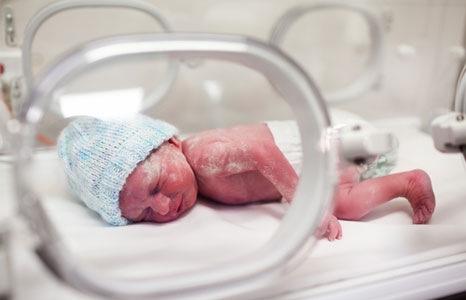 Когда ребенок может выжить при преждевременных родах