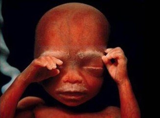 Фото плода на 20 неделе беременности (возраст плода 18 недель)