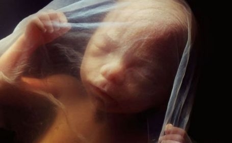 Фото плода на 24 неделе беременности (возраст плода 22 неделя)