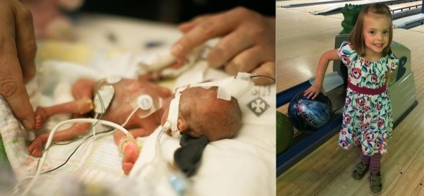 Фото детей рожденных на 25 неделе беременности и фото после