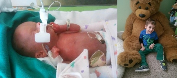 Фото детей рожденных на 24 неделе беременности и фото после