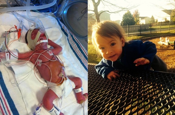 Фото детей рожденных на 27 неделе беременности и фото после