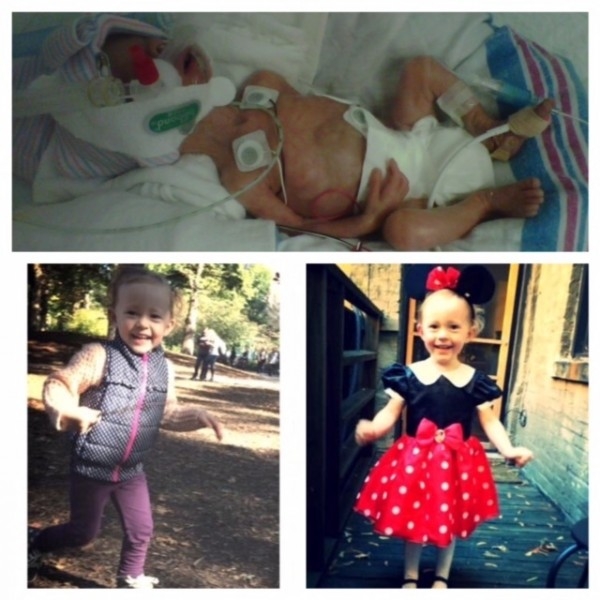 Фото детей рожденных на 27 неделе беременности и фото после