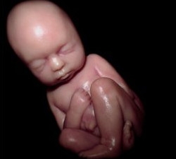 Фото плода на 29 неделе беременности (возраст плода 27 недель)