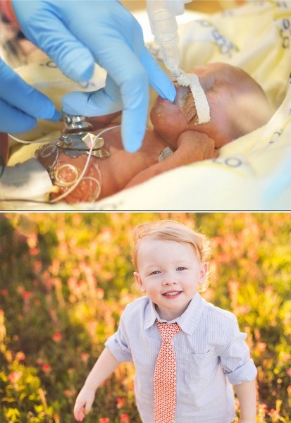 Фото детей рожденных на 29 неделе беременности и фото после