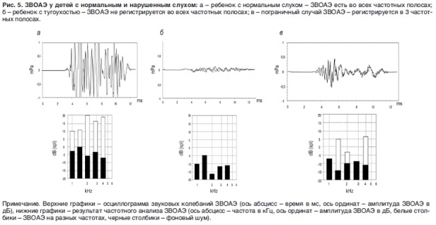 Результаты аудиоскрининга у детей с нормальным и нарушенным слухом