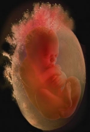 Фото плода на 31 неделе беременности (возраст плода 29 недель)