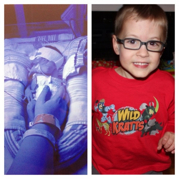 Фото детей рожденных на 31 неделе беременности и фото после