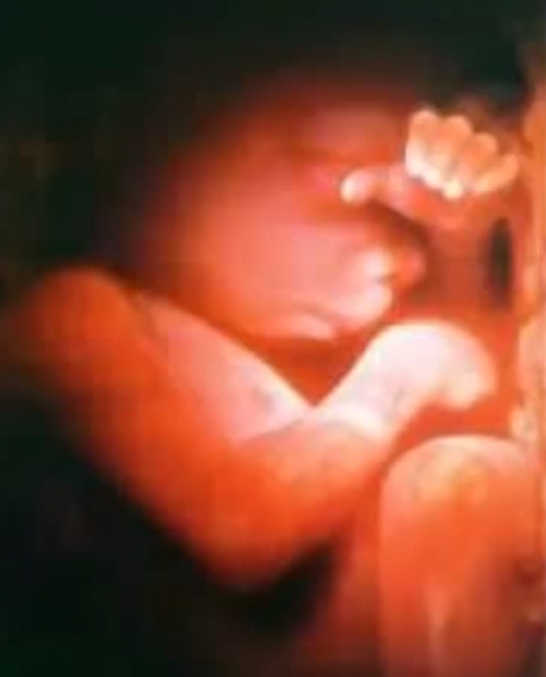 Фото плода на 32 неделе беременности (возраст плода 30 недель)