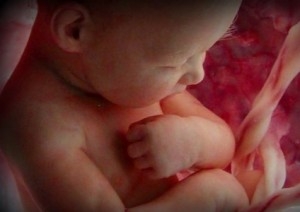 Фото плода на 33 неделе беременности (возраст плода 31 неделя)