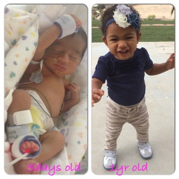 Фото детей рожденных на 33 неделе беременности и фото после