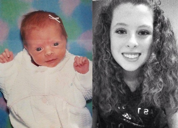 Фото детей рожденных на 35 неделе беременности и фото после