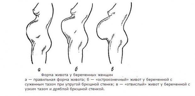 Форма живота при беременности
