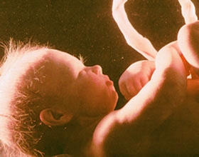 Фото плода на 36 неделе беременности (возраст плода 34 недели)