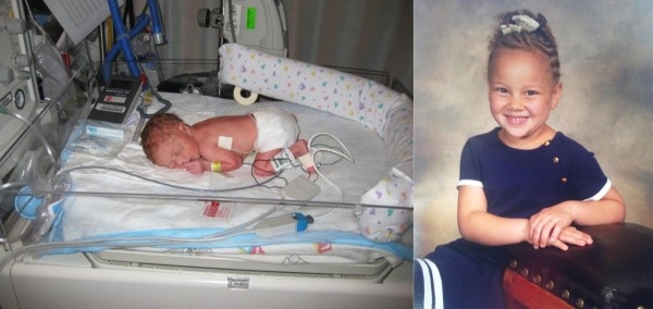 Фото детей рожденных на 36 неделе беременности и фото после