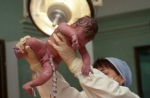 Фото плода на 40 неделе беременности (возраст плода 38 недель)