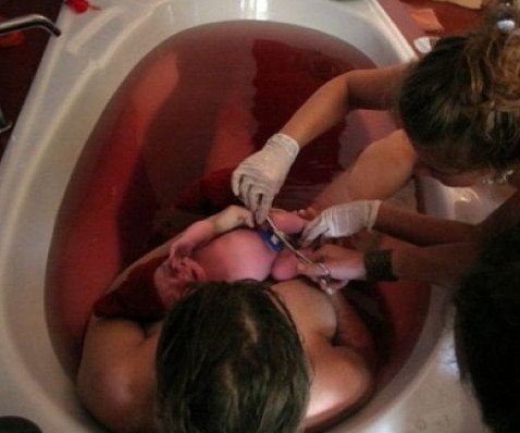 Роды в воде