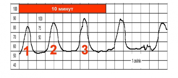 Нормальные схватки