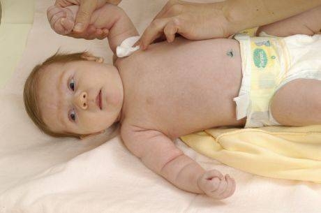 Гигиена складок кожи новорожденного