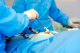 Лечение внематочной беременности