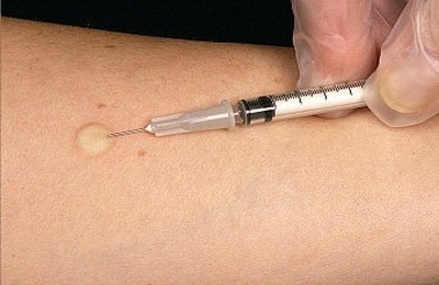 как делают манту