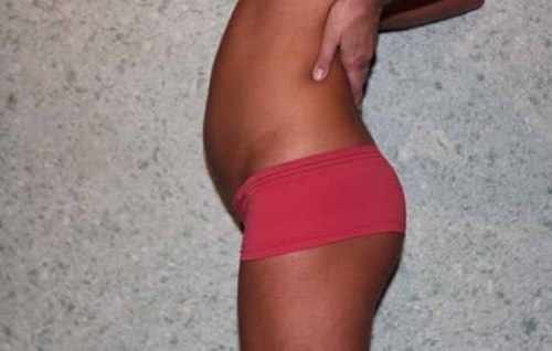 Фото живота на 3 месяце беременности