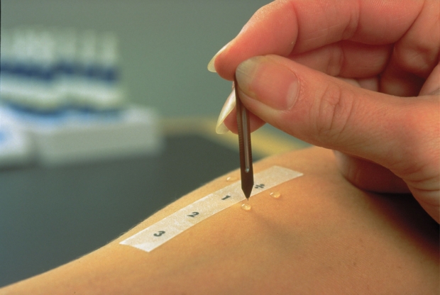 аллегопробы