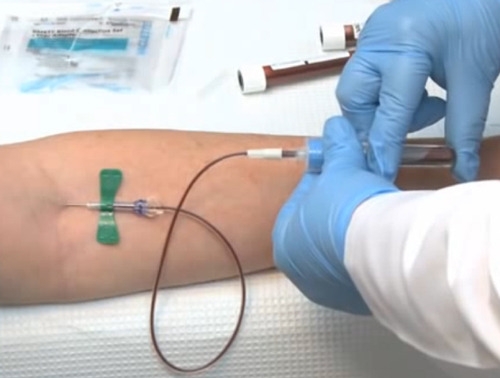 как берут кровь на аллергию