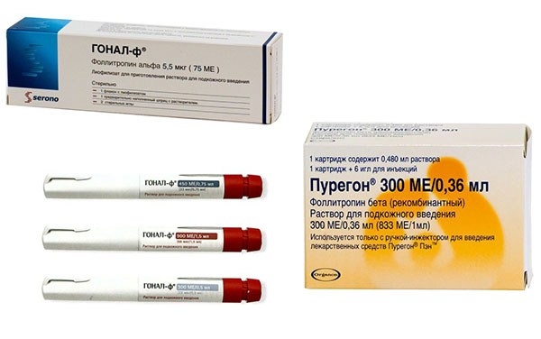Стимуляция Гоналом